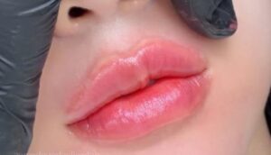 Phun môi trong kỷ nguyên làm đẹp tự nhiên lên ngôi