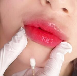 Phun môi cho người sợ đau: trải nghiệm thực tế không như lời đồn