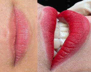 phun môi và môi khô