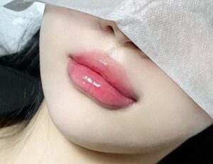 Phun môi có làm thay đổi hình dáng môi tự nhiên không?