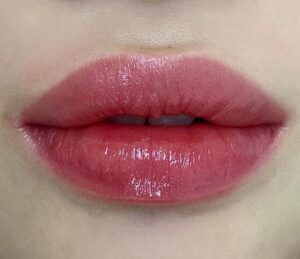 Môi bị bong vảy thành nhiều mảng? Tại sao và cách xử lý đúng