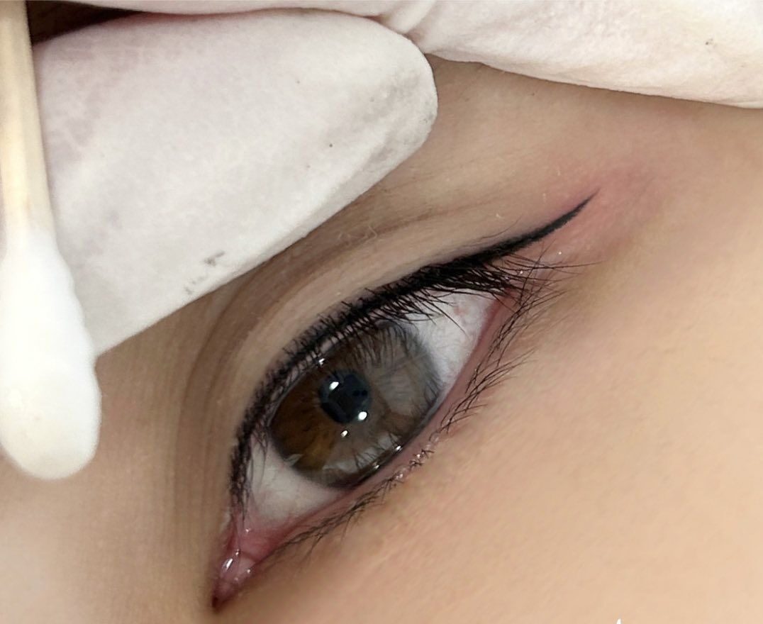 Bảng giá phun xăm chân mày, môi & mí mắt cập nhật 2026 3 Phun xăm mí mở tròng – Phương pháp & những điều cần biết