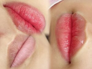 Những món ăn tưởng vô hại nhưng lại khiến môi sau phun lâu lên màu