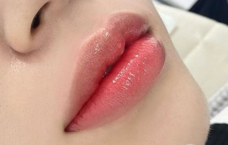 Nếu phun môi là một cuộc đầu tư, thì đây là thứ bạn nhận được sau 30 ngày