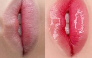 Phun môi cho người hay cắn môi, liếm môi: Nên hay không?