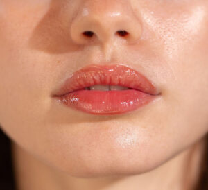 Những rủi ro tiềm ẩn của phun môi mà nhiều người thường bỏ qua