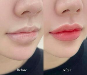 Phun môi – Đẹp là khi người khác thấy bạn tươi, không biết vì sao