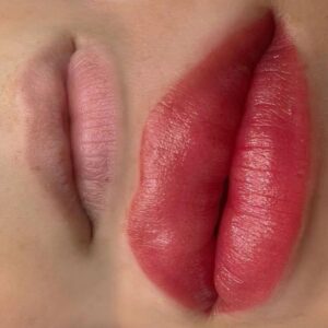 Phun môi bao nhiêu tuổi thì an toàn? Câu trả lời theo y khoa