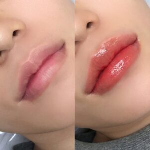 Phun môi bao nhiêu lần là đủ trước khi môi bị quá tải sắc tố?