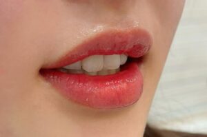 Một lần phun môi có thể thay đổi điều gì trên gương mặt bạn?