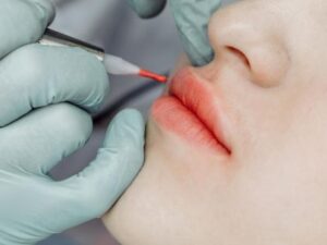 Phun môi không chỉ là làm đẹp: vì sao ngày càng nhiều người chọn phương pháp này?