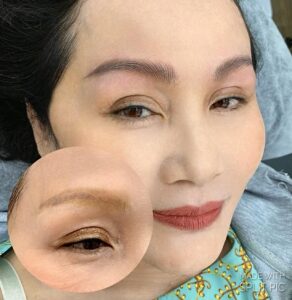 Mất niềm tin sau phun xăm hỏng: có nên làm lại hay không?