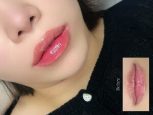 Phun môi có thật sự che được môi thâm nặng hay chỉ cải thiện bề mặt? 2 Từ môi hỏng đến môi chuẩn beauty: 5 giai đoạn bạn sẽ thấy