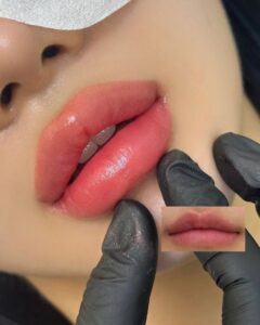 Phun môi có “già hóa” môi không? Sự thật ít nơi dám nói rõ