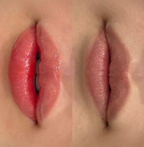 Phun môi – Không tạo ra một đôi môi mới, chỉ làm môi cũ đẹp hơn