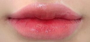 Phun môi và hành trình lấy lại sự tự tin với mặt mộc