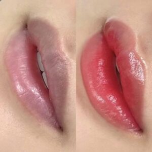 Phun môi nhưng không bong vảy: Có thật hay chỉ là quảng cáo?