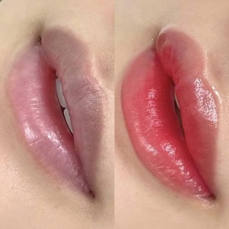 Phun môi nhưng không bong vảy: Có thật hay chỉ là quảng cáo?