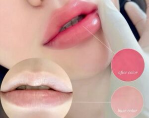 Phun môi có tác dụng chống khô môi mãi mãi không?