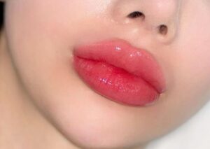 Ăn gì / kiêng gì trong 48 giờ đầu sau khi phun môi?