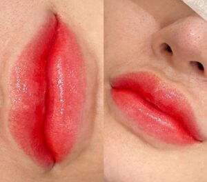 Môi từng phun hỏng có thể phun môi lại được không?