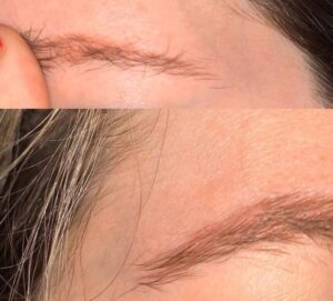 Những lỗi phun xăm chân mày thường gặp và cách khắc phục nhanh?