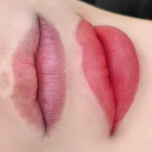 Phun môi có thực sự không đau như quảng cáo? Giải thích chuyên sâu!