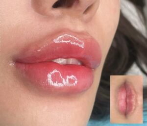 Phun môi – Chạm rất khẽ để nét đẹp ở lại rất lâu