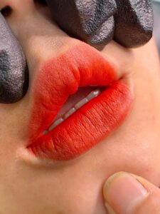 Có nên phun môi khi đang niềng răng? Chuyên gia phân tích