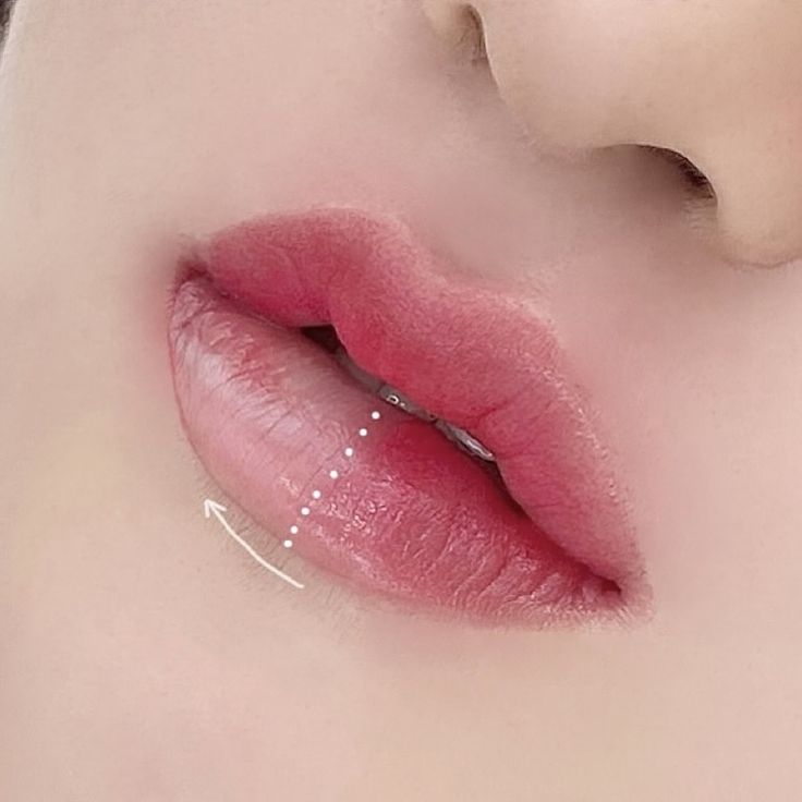 đôi môi đẹp sau phun