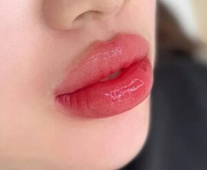 Màu môi trendy 2026: gợi ý cho mỗi tone da 1 Phun môi xong bị sưng to - bình thường hay bất thường?