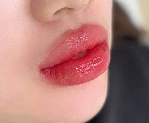 Phun môi nano: Ưu điểm, quy trình và kết quả thực tế 2 Phun môi xong bị sưng to - bình thường hay bất thường?