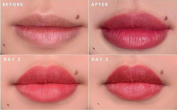 Các kỹ thuật phun môi hiện đại: Nên chọn phương pháp nào?