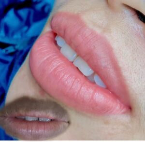 Cách xử lý môi thâm trước khi phun môi để màu lên đẹp như ý