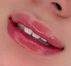 Khử thâm môi bằng phun xăm: mọi điều chị em cần biết trước khi làm