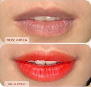 Khử thâm môi là gì? Giải pháp giúp môi hồng hào tự nhiên