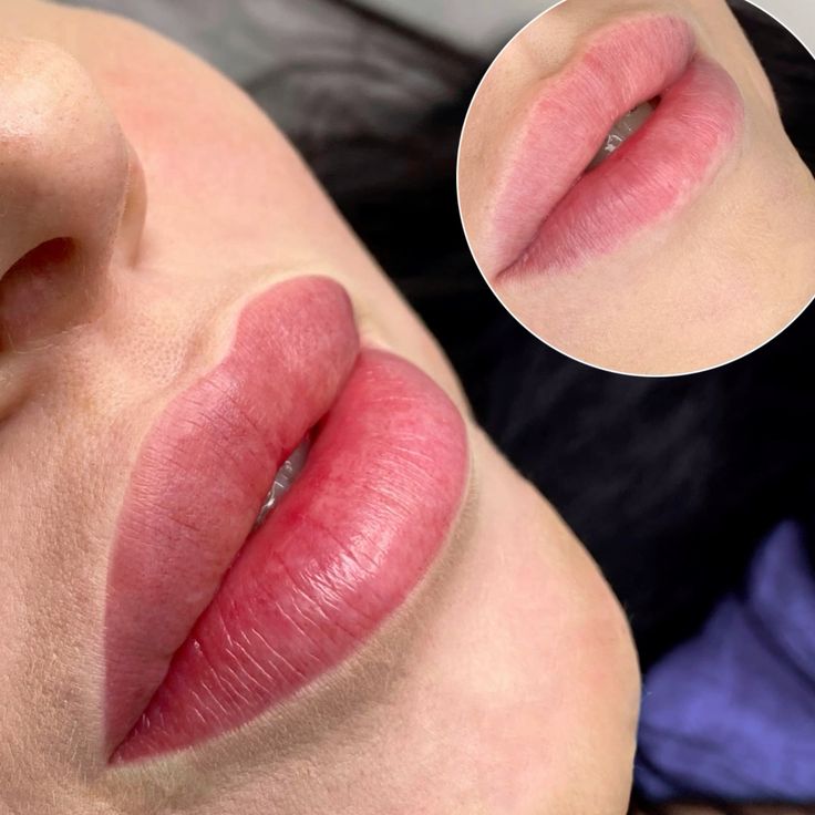 Nên phun môi hay khử thâm môi trước?