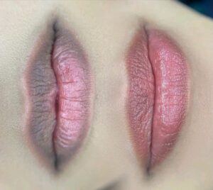 Những nguyên nhân khiến môi thâm và cách khắc phục hiệu quả