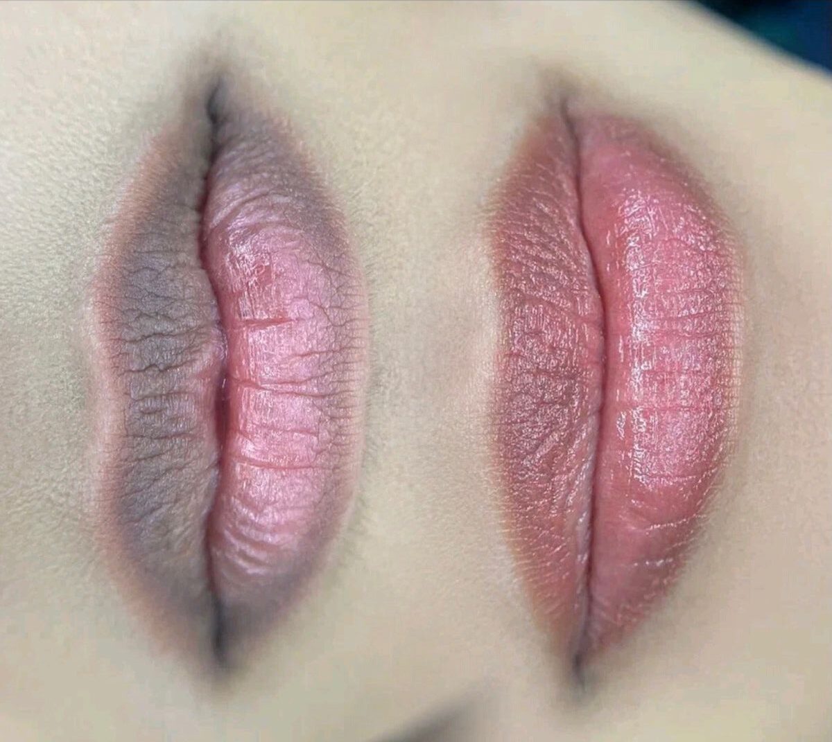 Phun môi chuẩn tự nhiên: Cách chọn màu môi phù hợp với từng tông da 3 Những nguyên nhân khiến môi thâm và cách khắc phục hiệu quả