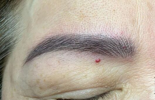 Phun chân mày nên kiêng ăn gì để tránh thâm mày sau bong?