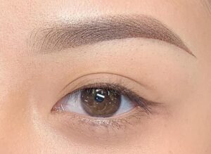 Phun mày có phải kiêng ăn không? Danh sách thực phẩm nên và không nên