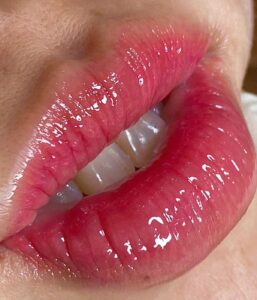 Phun môi 3D & phun môi pha lê: Có gì khác & nên chọn công nghệ nào?