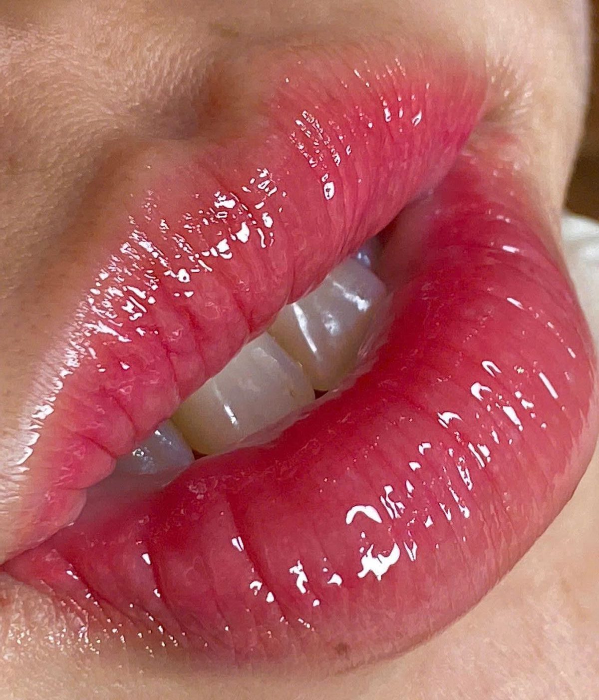 Phun môi 3D & phun môi pha lê: Có gì khác & nên chọn công nghệ nào?