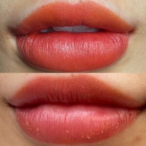 Phun môi ăn trứng được không? Giải đáp chi tiết theo từng giai đoạn hồi phục 1 Phun môi bị sưng bao lâu thì hết? Dấu hiệu bình thường hay bất thường