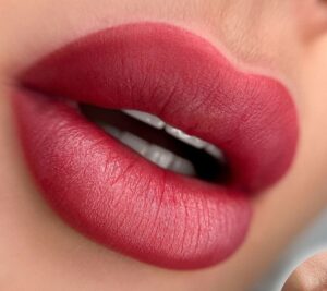 Phun môi bị sưng có nguy hiểm không? Khi nào cần đi khám ngay