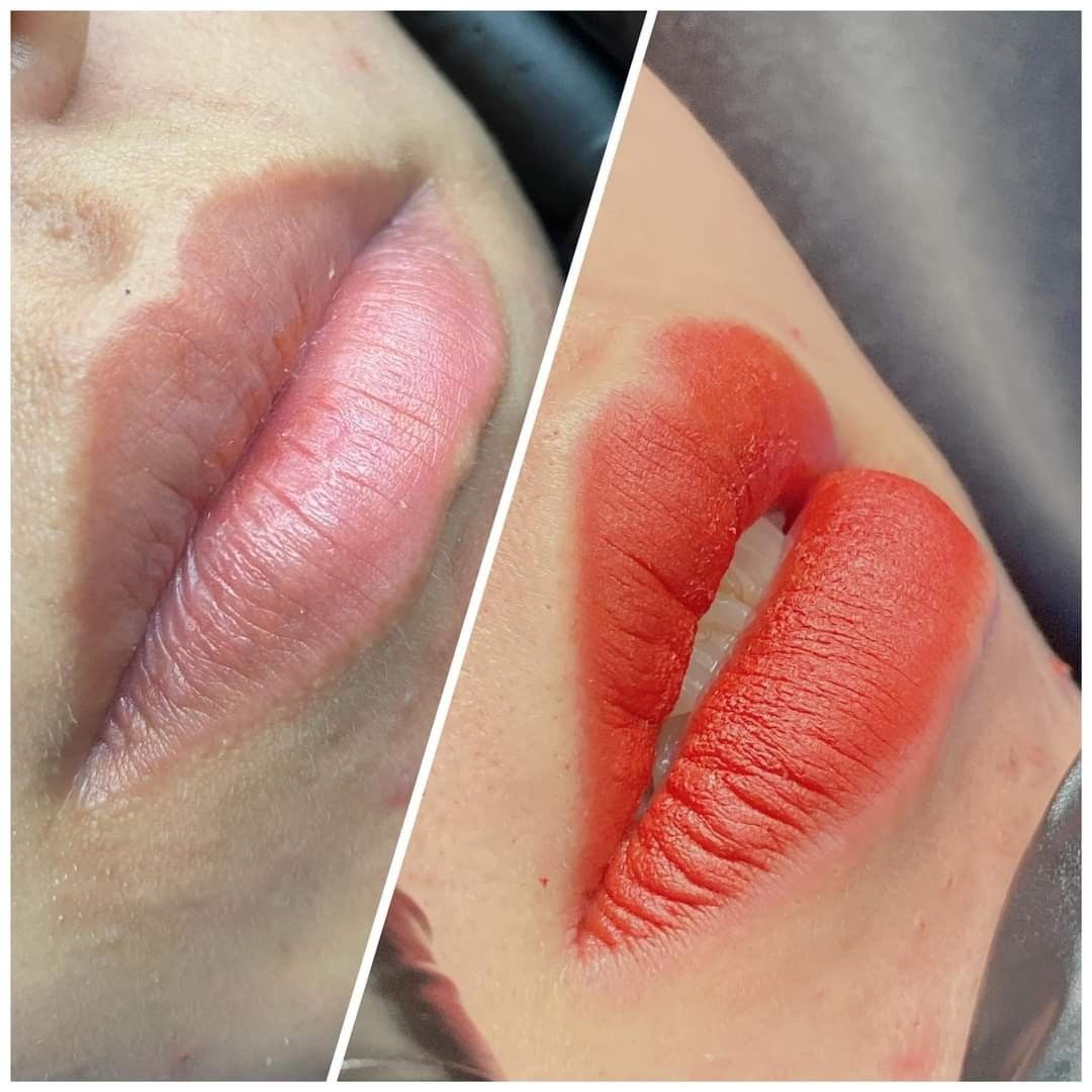 Phun môi collagen vs phun môi pha lê: Ưu nhược điểm từng kỹ thuật 1 Phun môi collagen vs phun môi pha lê: Ưu nhược điểm từng kỹ thuật