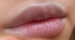 Phun môi không lên màu: Nguyên nhân do kỹ thuật hay cơ địa?