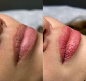 Phun môi khử thâm có thật sự giúp môi hồng tự nhiên như mong đợi?