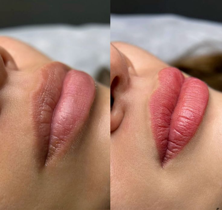 Phun môi khử thâm có thật sự giúp môi hồng tự nhiên như mong đợi? 1 Phun môi khử thâm có thật sự giúp môi hồng tự nhiên như mong đợi?