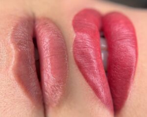 Phun môi lụa cho môi thâm – Có nên thực hiện?